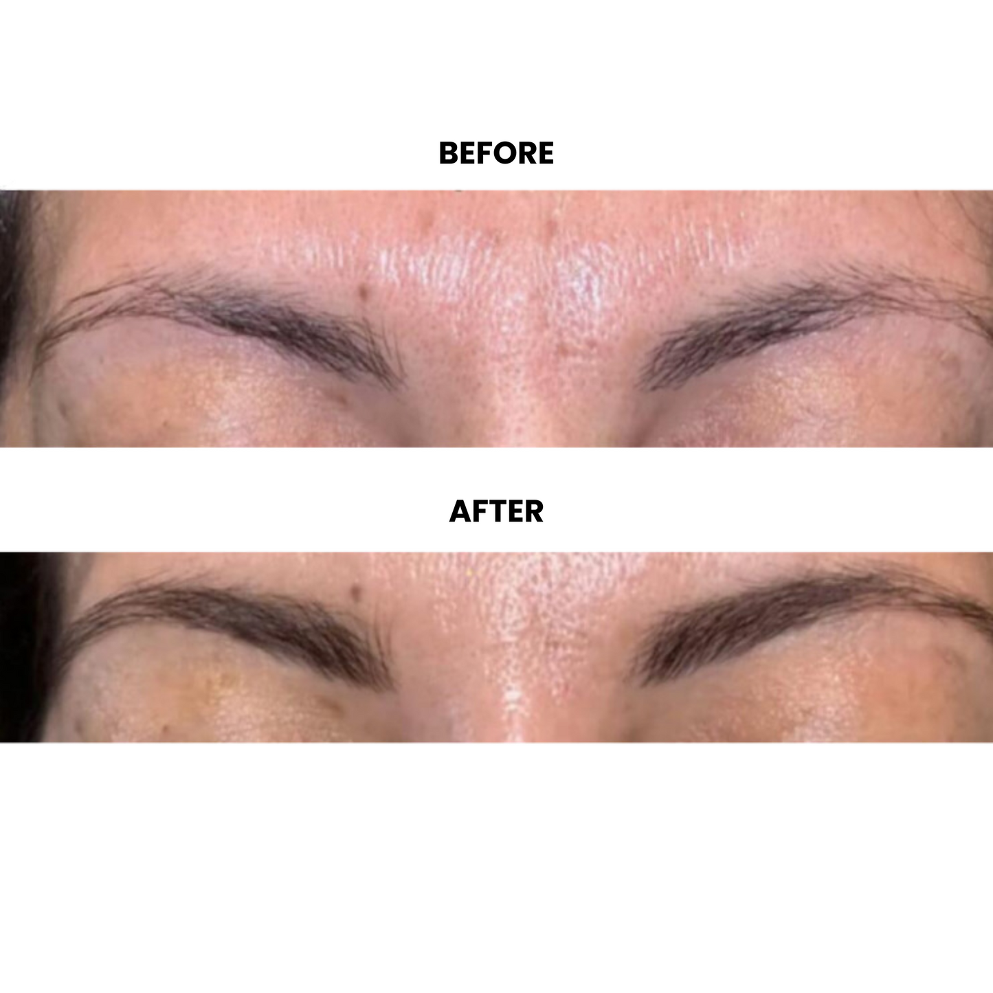 Aurilaya Eyebrow Serum