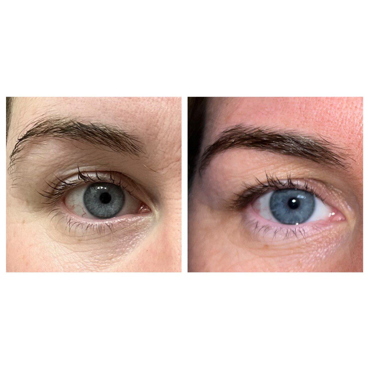 Aurilaya Eyebrow Serum